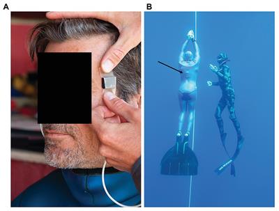 Using Underwater Pulse Oximetry in Freediving to Extreme Depths to Study Risk of Hypoxic Blackout and Diving Response Phases